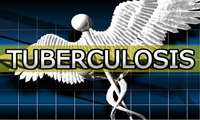 اطلاعات جدید نشان داده که تست آزمایشگاهی می تواند در تفکیک افراد مشکوک مبتلا به سل به پزشکان کمک نماید. 