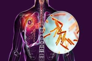 داروی جدید ممکن است سرانجام سل را فریب دهد